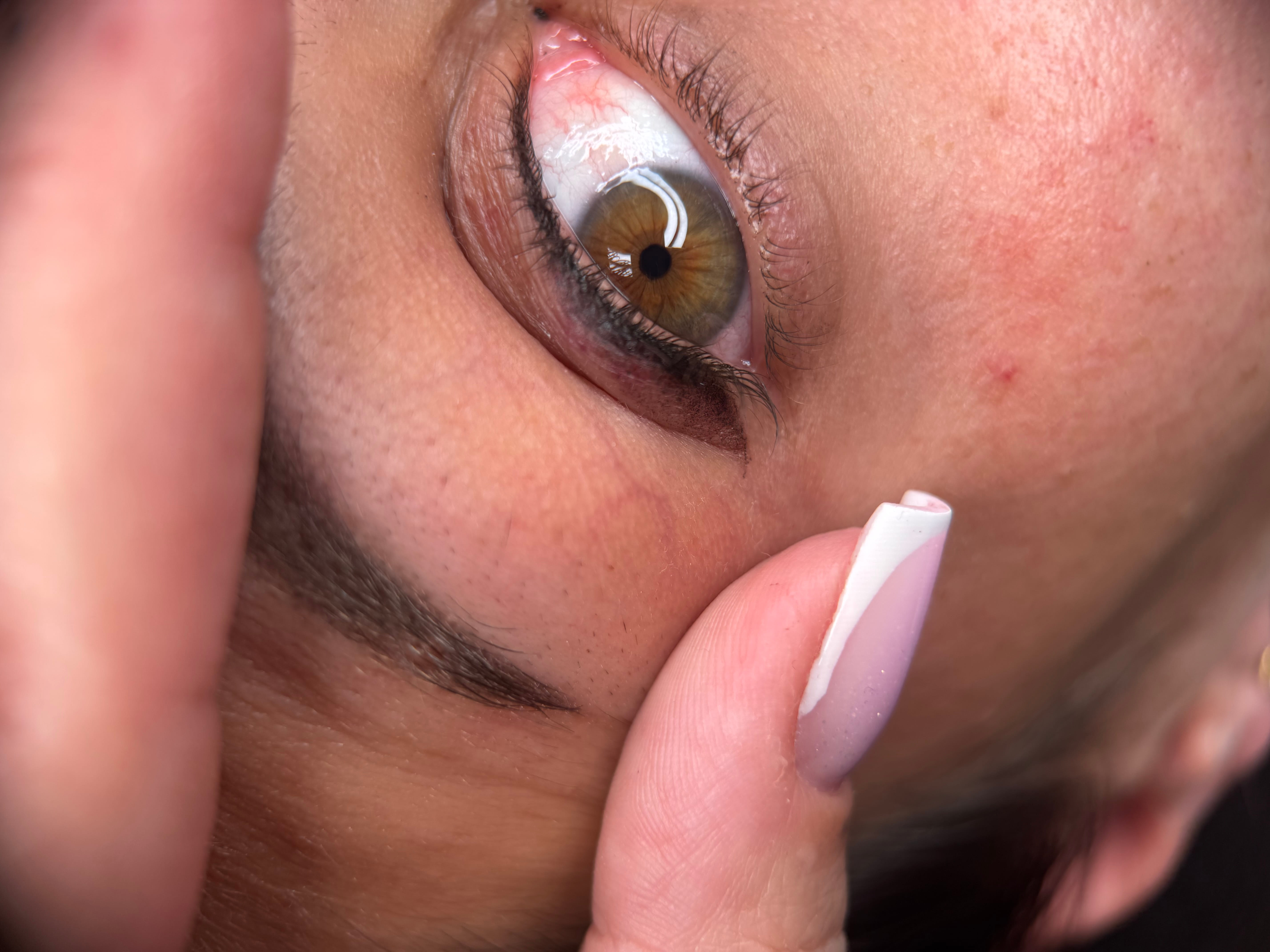 Softliner & Wimpernkranzverdichtung Ergebnis