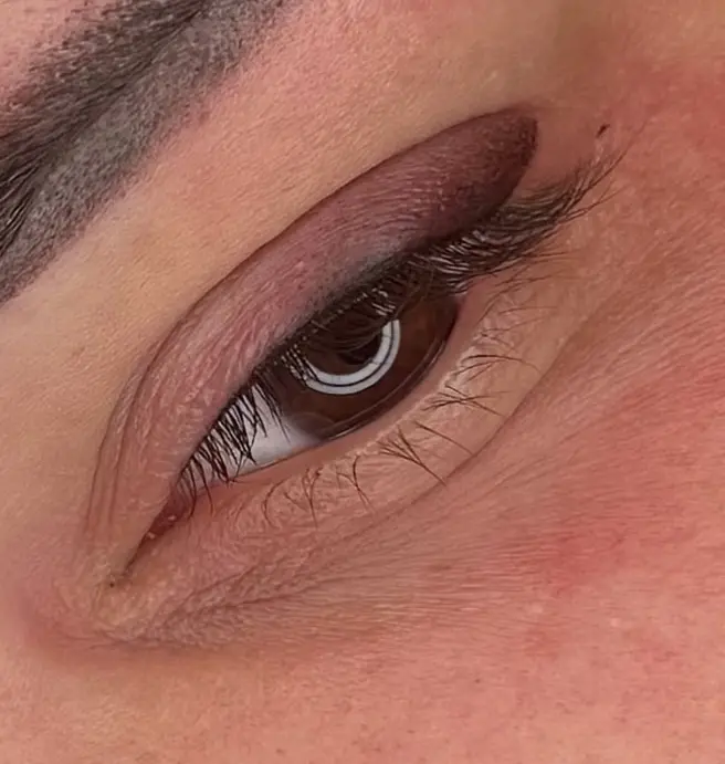 Softliner & Wimpernkranzverdichtung Ergebnis