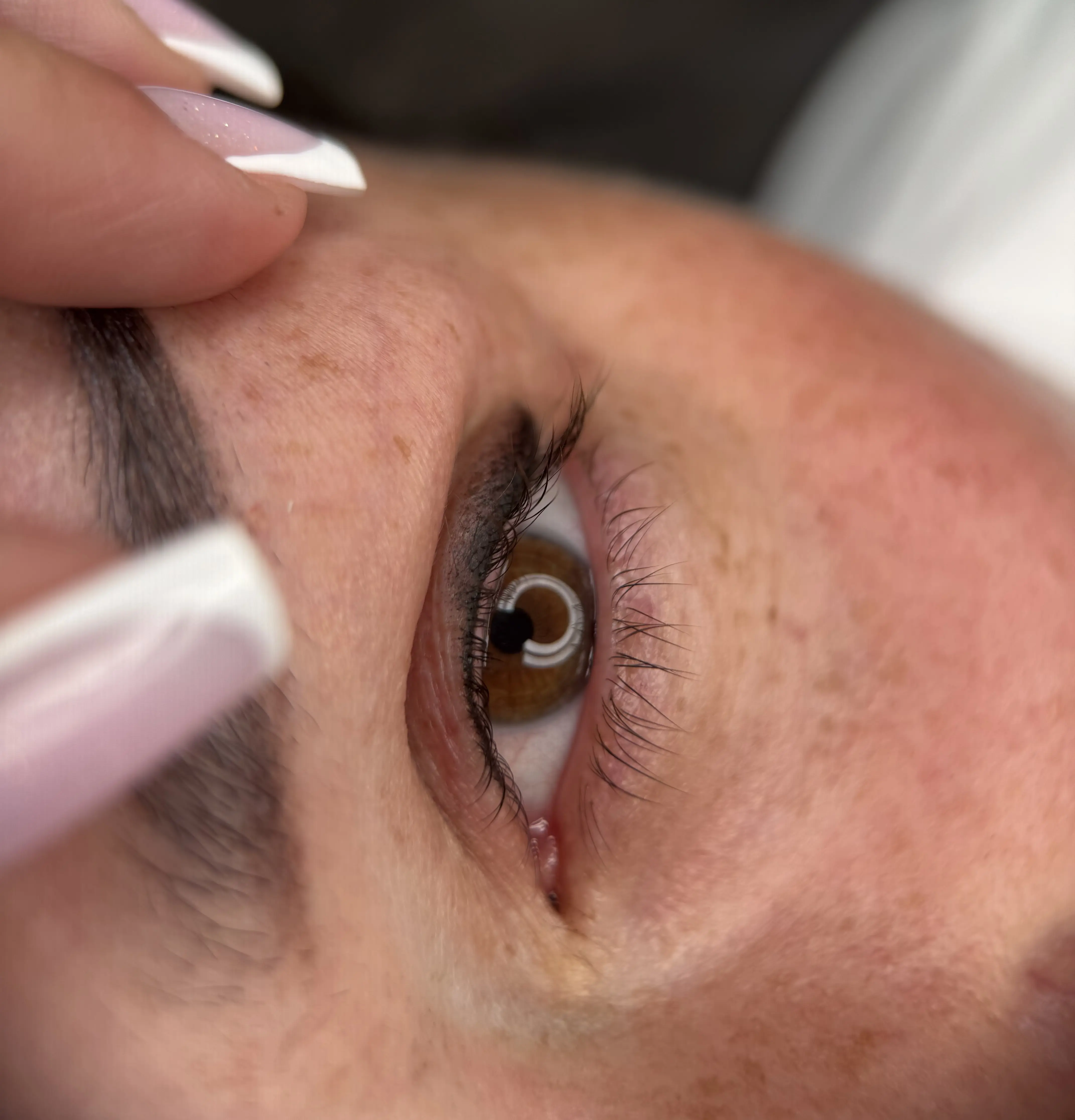 Softliner & Wimpernkranzverdichtung Ergebnis